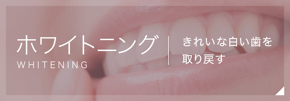 ホワイトニング　きれいな白い歯を取り戻す
