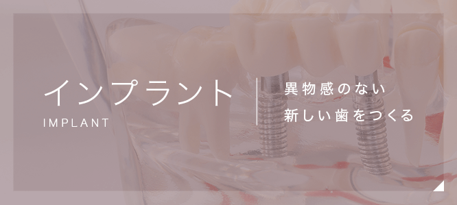インプラント　異物感のない新しい歯をつくる