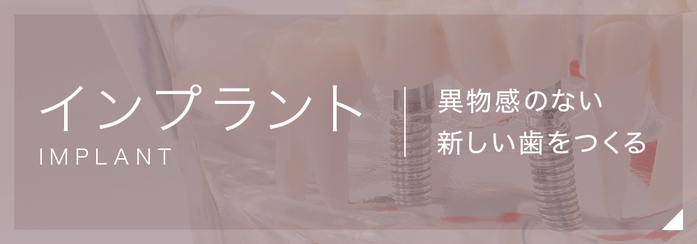 インプラント　異物感のない新しい歯をつくる